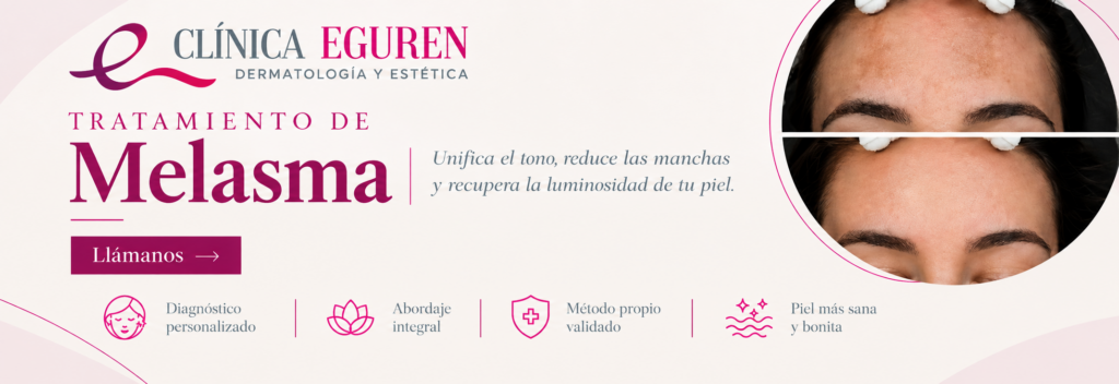 Banner Clínica Eguren: tratamiento de melasma que unifica el tono y reduce las manchas, antes y después en frente